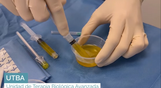 Foto 25 años cambiando la conversación en traumatología: preservar antes que sustituir